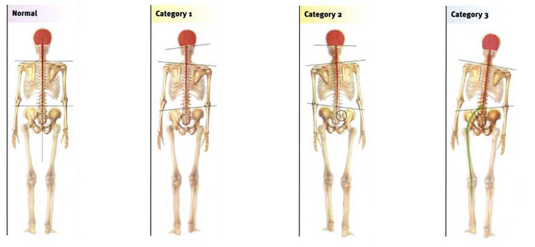 skeleton categories